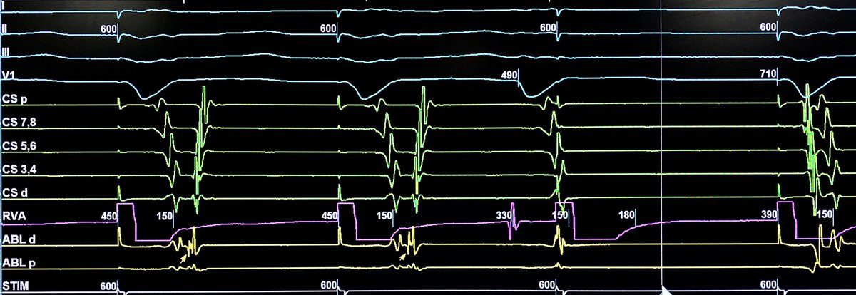 EP is cool. A little grin came over my face when I saw this. #EPeeps
