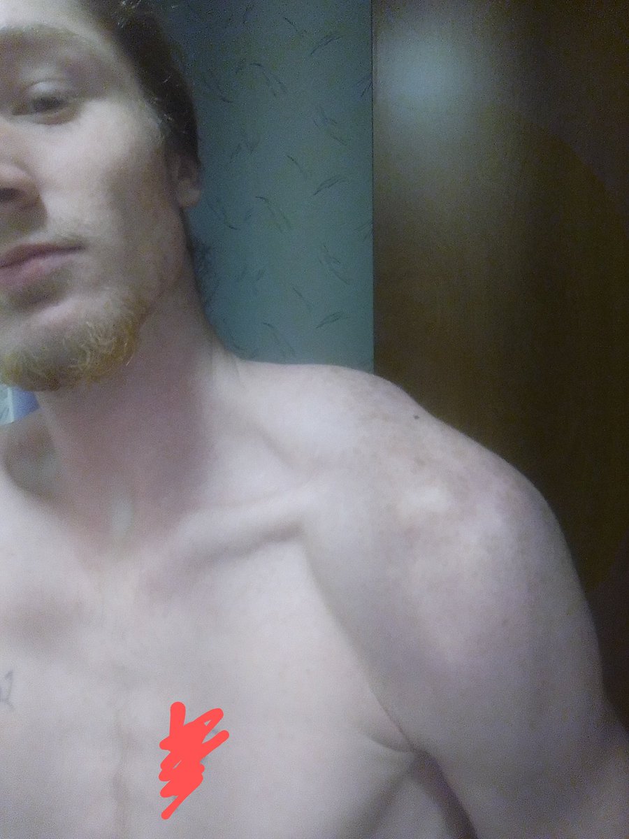 AlphaShua's tweet photo. Ah what's up faggots guess who moved to Vermont. Now I can't really drain everything out of you faggots https://t.co/PAqOJisNl5