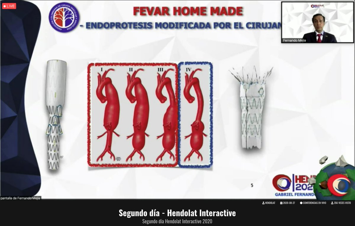 hendolat's tweet photo. AAA ANATOMÍA COMPLEJA / FEVAR
#HENDOLATinteractive2020 🌎
#ProgramaAcademicoHENDOLAT
#CongresoAnualHENDOLAT
#somosHENDOLAT
#HENDOLAT2020 https://t.co/vphaYRpihU