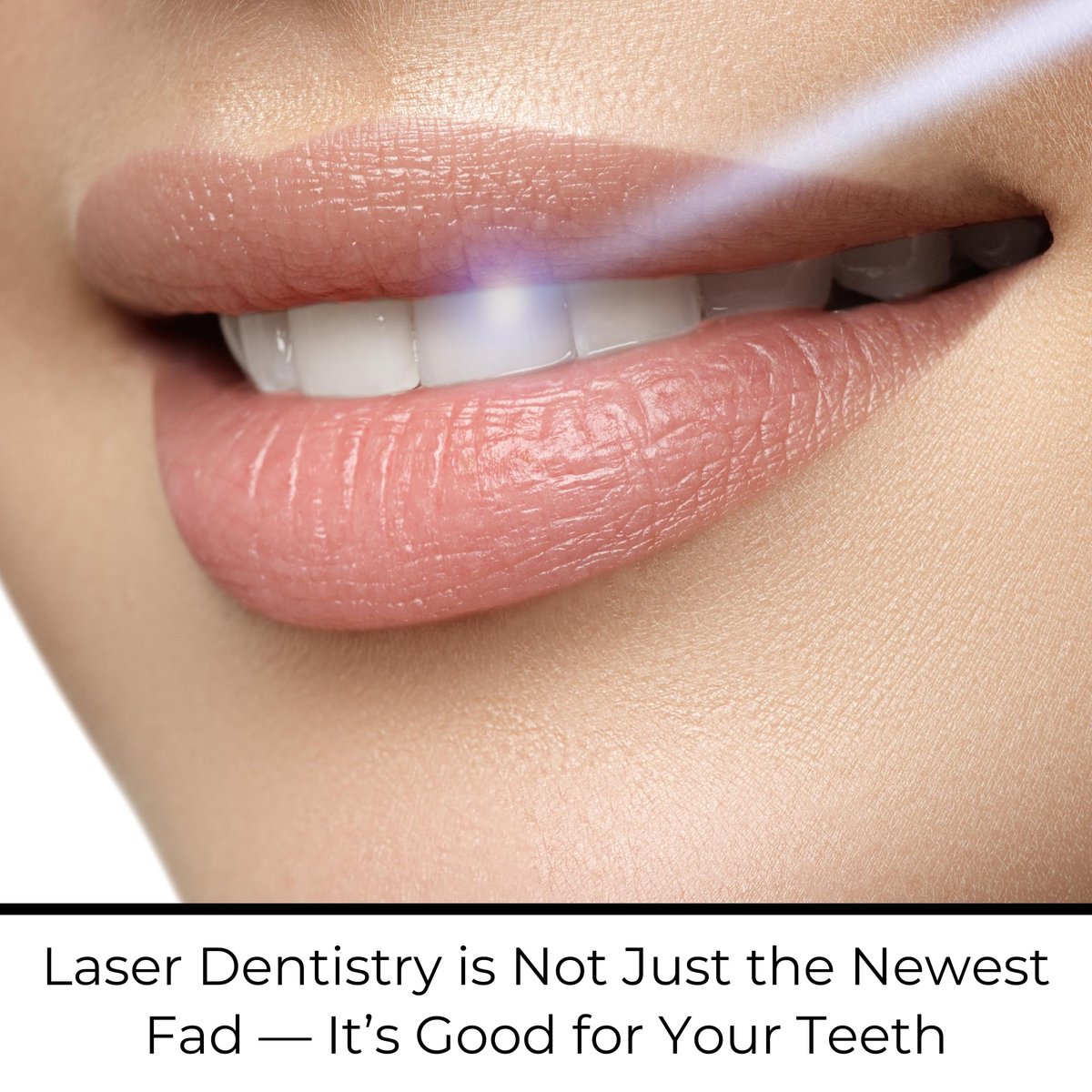 You may have heard dentists talking about laser dentistry in the past few years, and now you’re wondering what it’s all about. Well, laser dentistry could really help your teeth and your overall smile.

Learn more at drandreastevens.com/blog/laser-den….

#DrAndreaStevensDentistry