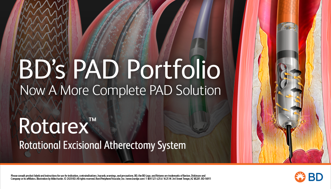 BD offers a comprehensive product portfolio for the treatment and management of Peripheral Arterial Disease, and now includes the #Rotarex #RotoExcisional Atherectomy System. Learn More:  bit.ly/2DNa1OU