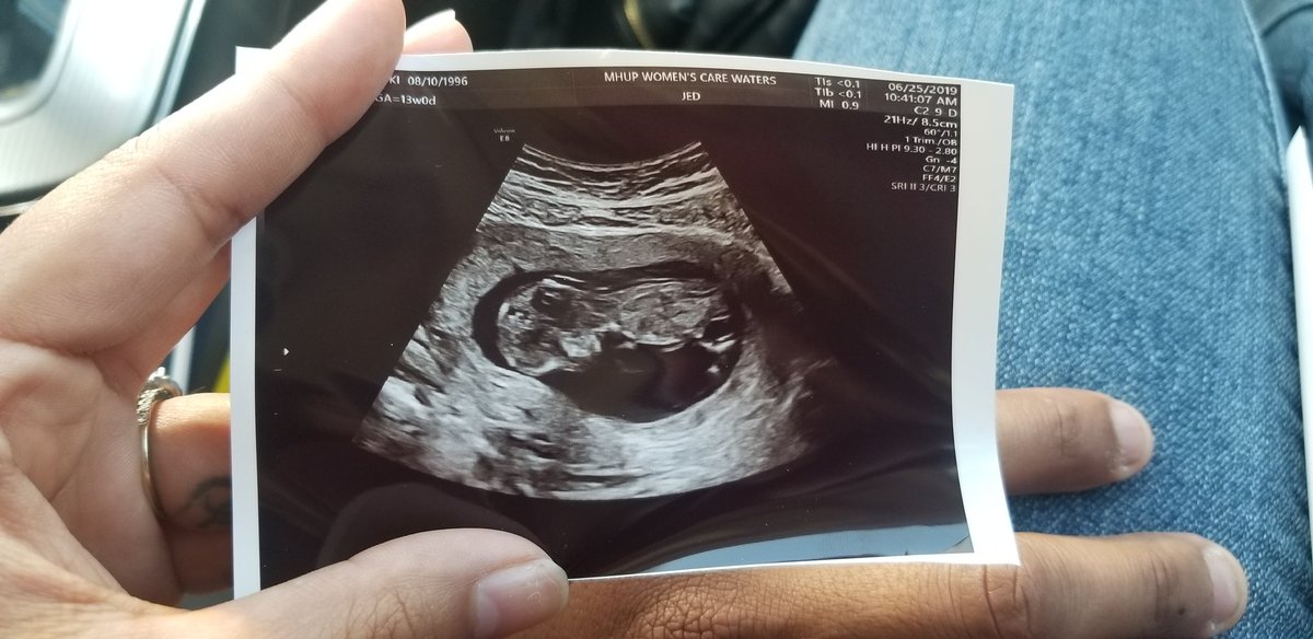 _yukiii__'s tweet image. The ultrasound ❤ The bump 🤰🏽The newborn 👶🏽 Now 💜 #BabyKai
