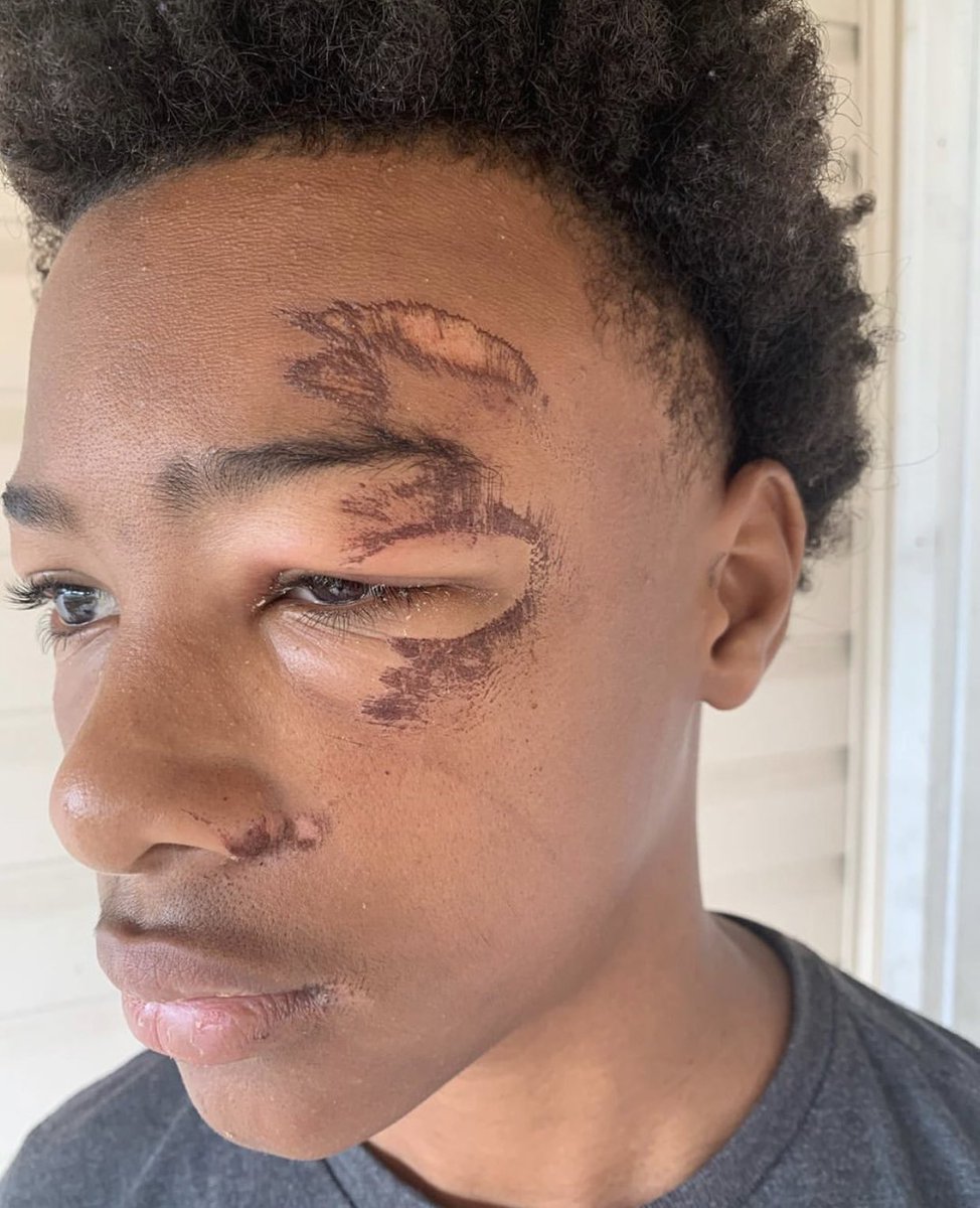 Show me a 13 year old white kid beat like this by the cops. This kid is 13 years old. Officer Kairo according to the victims mom knocked her son unconscious. I need you to read this post by this mother in Jefferson Parish. (Please read each tweet in this thread)