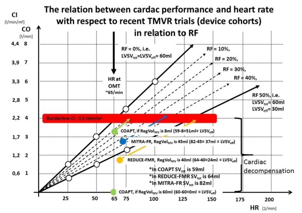 EulertJ's tweet photo. Hot of the Press: Discussing "Disproportionate" MR & plausibility in TMVR trials
RegVolMV= LVSVtot-LVSVeff = 59ml -51ml = 8ml regurgitant Vol -> mild MR #echofirst
#tmvr #coapt #mitrafr #heartfailure https://t.co/wlpHyT1IFD https://t.co/idQawycxfi
