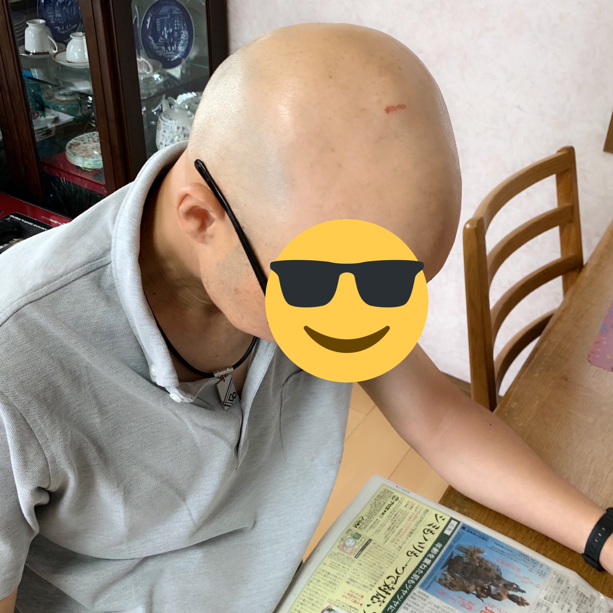 Uzivatel たまc Na Twitteru うちの父親スキンヘッドなんだけど 頭ぶつけたとこ貯金箱みたいになっててわろた T Co Pmx63foqsg Twitter Uzivatel たまc Na Twitteru うちの父親スキンヘッドなんだけど 頭ぶつけたとこ貯金箱みたいになっててわろた T Co Pmx63foqsg Twitter