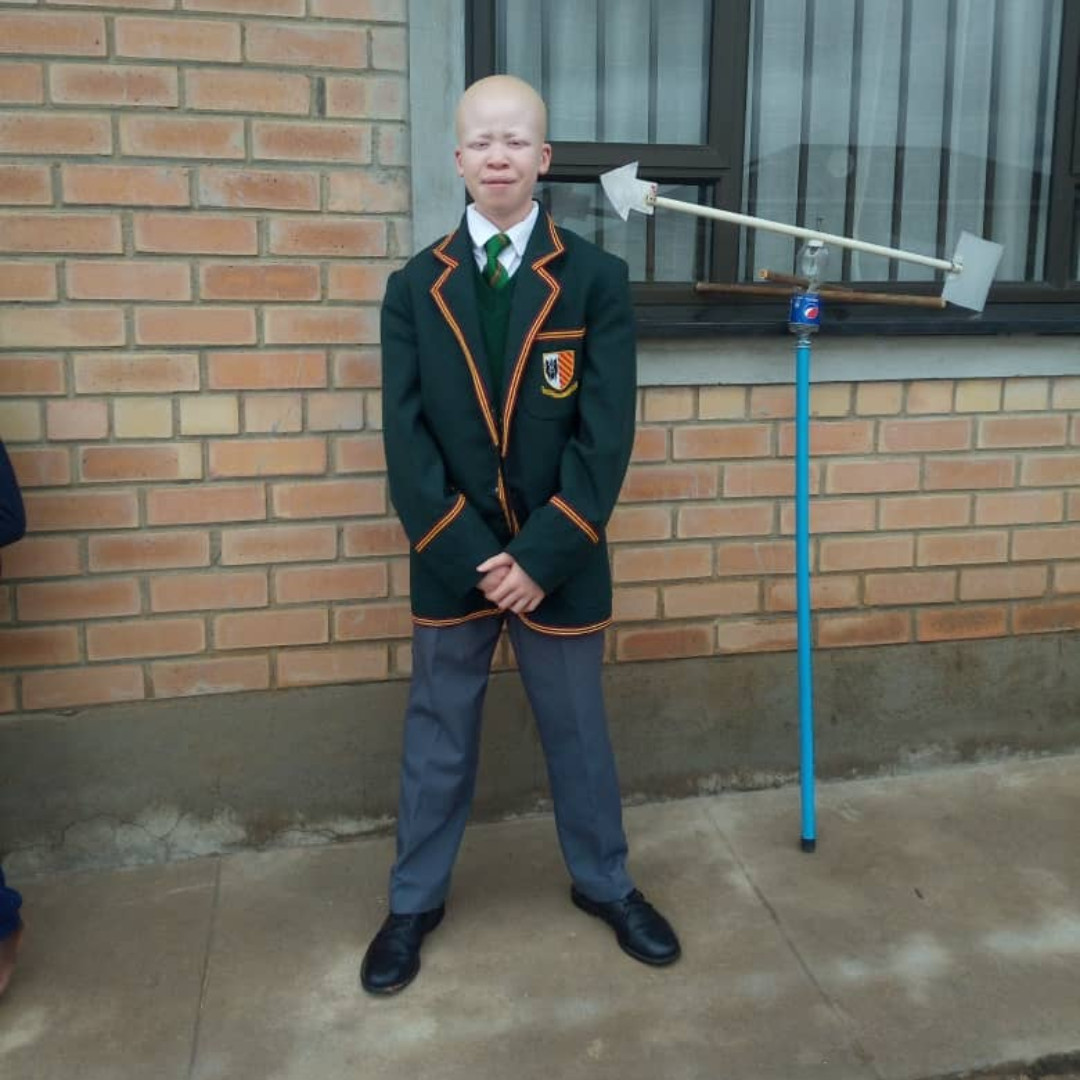 Being born with albinism is not a crime neither is it a curse.  We are just normal beings. My biggest enemy is the sun and I cannot play any outdoor games like other children, Jayden Manyika tells <a href="/UNICEF/">UNICEF</a>.

Read his story:  uni.cf/34JlVo6