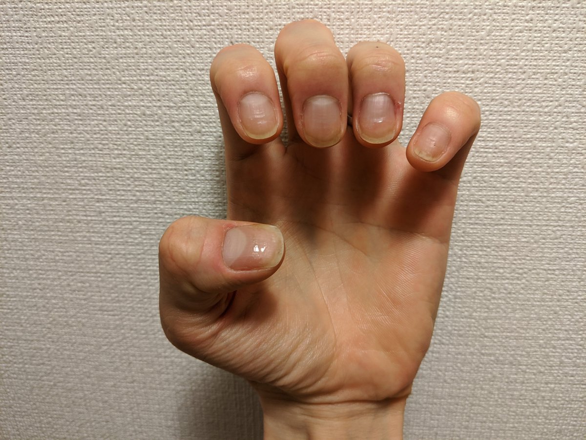 爪噛み男 Nail Biter Flat95 Twitter