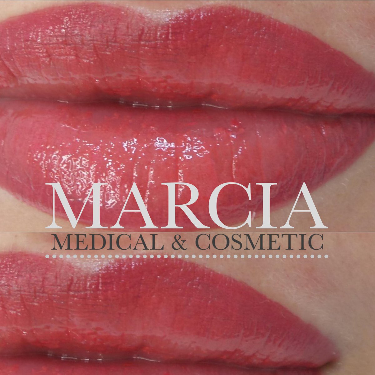 Marcia_MCTS's tweet photo. 💋Lip Snacking! 🤍
Immediately after Full Lip Blush. Will fade during healing to soft colour, perfectly defining and volumising the lips without filler.
You just need to Gloss &amp; Go! 💋
You will agree they are fabulous! #lips #liptattoo #lipgloss #semipermanentmakeup https://t.co/V63YlBGOQl
