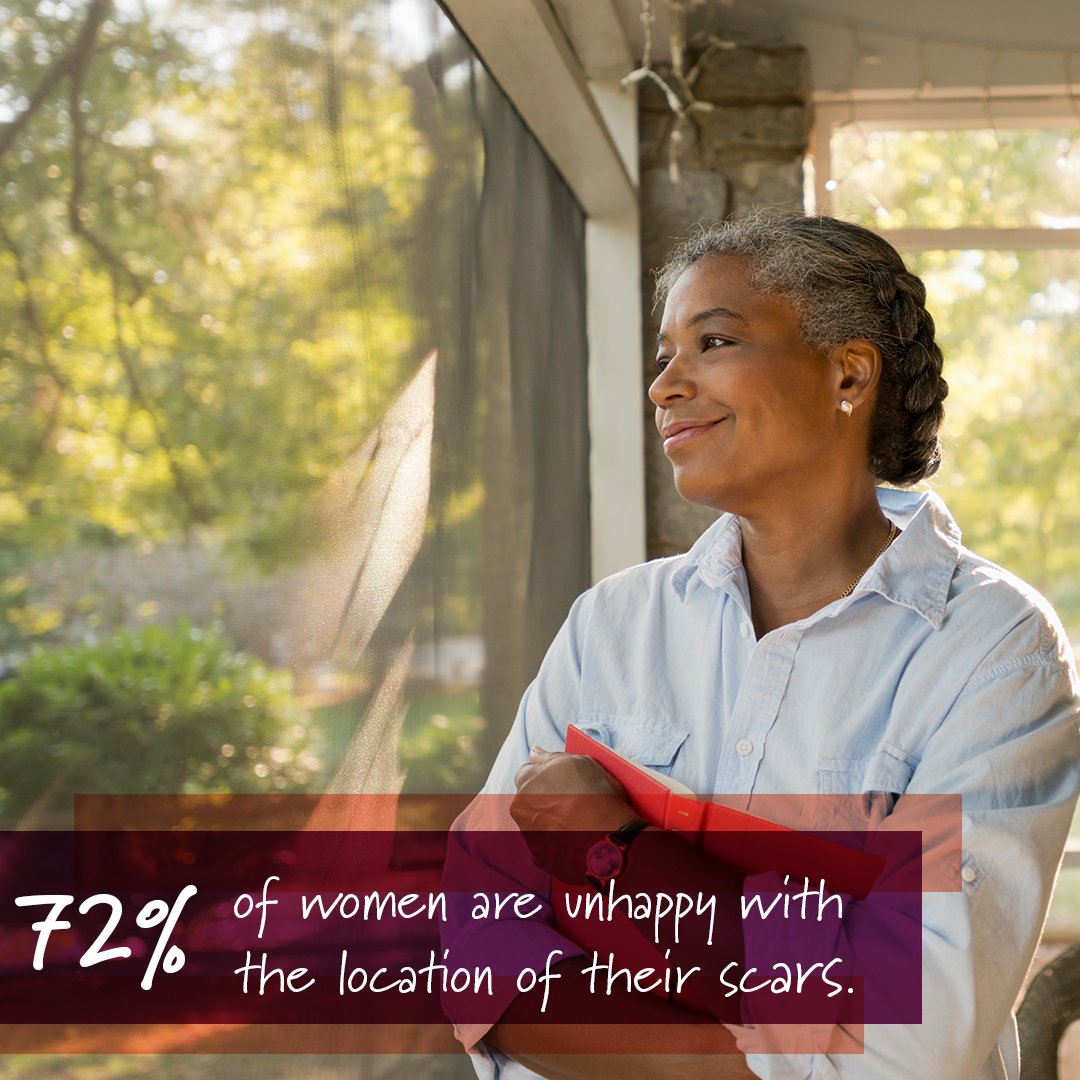 myhiddenscar's tweet image. Scars matter to some women and 72% of women are unhappy with the location of theirs. But there is hope – the Hidden Scar Breast Cancer Surgery helps provide no visible reminders so you can feel and look your best. #HiddenScar #BreastCancerSurgery