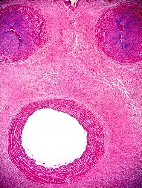 Drshalini01's tweet image. Hello 😀😀😀😀 #twitterpath #placentapath #histopath 😀