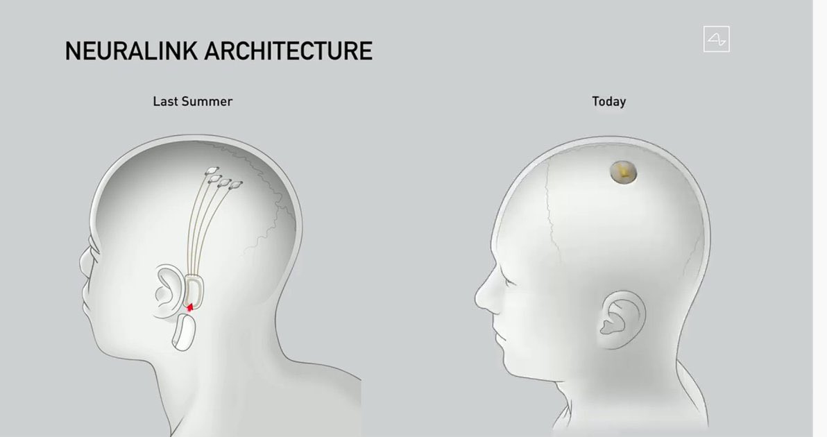 Samservin_'s tweet photo. Elon Musk, en la presentación de Neuralink, afirma que implantando el chip electrónico en el cerebro es posible "apagar el switch" de la depresión, pérdida de memoria, ceguera, parálisis, insomnio, adicción, ansiedad, etc. https://t.co/HThRp2MyBs