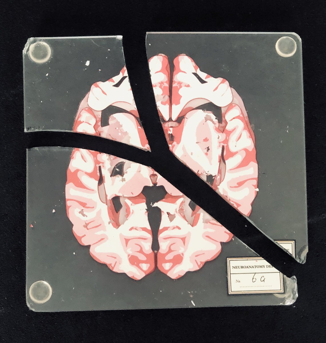 I don’t think I’ve learnt how to fix this brain problem during residency 😕@EmoryNeurology. I’m sorry @andresdeleonb I broke your 🧠coaster.