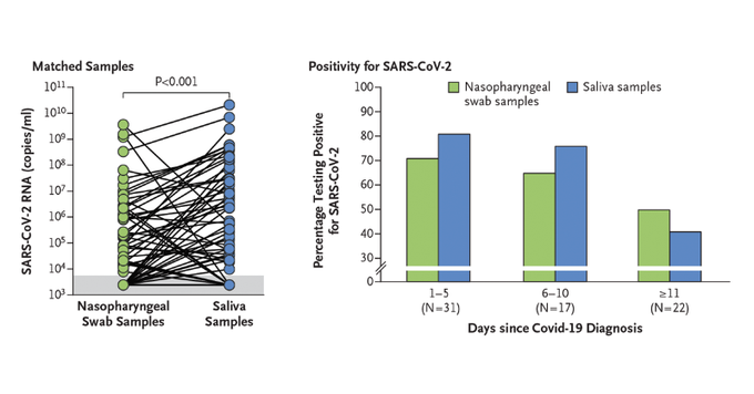EddieRDMD's tweet photo. NEJM: Investigators report that saliva specimens and nasopharyngeal swab specimens had similar sensitivity in the detection of SARS-CoV-2 RNA in both symptomatic and asymptomatic persons. https://t.co/ziRTSCAKoW @_atanas_ https://t.co/D88yJWcPci