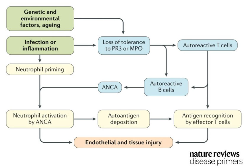 Kitching Laboratory (@kitchinglab) on Twitter photo Summary of processes thought to cause acute severe injury in ANCA-associated #vasculitis (GPA/MPA), from our review in Nat Rev <a href="/DiseasePrimers/">Nature Reviews Disease Primers</a>. Research from many people incl <a href="/UNCKidney/">UNC Kidney Center</a>, @VasculitisUMCG and other <a href="/RELENT_EU/">RELENT project</a> members - and many others. It's complicated and unique! Summary of processes thought to cause acute severe injury in ANCA-associated #vasculitis (GPA/MPA), from our review in Nat Rev <a href="/DiseasePrimers/">Nature Reviews Disease Primers</a>. Research from many people incl <a href="/UNCKidney/">UNC Kidney Center</a>, @VasculitisUMCG and other <a href="/RELENT_EU/">RELENT project</a> members - and many others. It's complicated and unique!