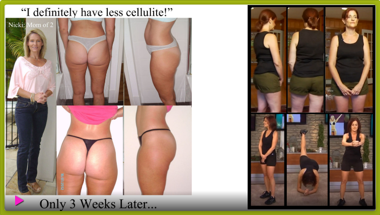 Fatloss_Product's tweet photo. Product Name - #Cellulite Gone 
No Weight Loss, No Gym Routine

Simple Laser-targeted Home-toning Method Works Bigtime
The Only Proven Way For Women To Kill Cellulite Forever.

More Info
👇👇
https://t.co/ycBQqWumNq

#weightloss #fatloss #weightlossjourney #weightlossdiet https://t.co/d8dzunvyao