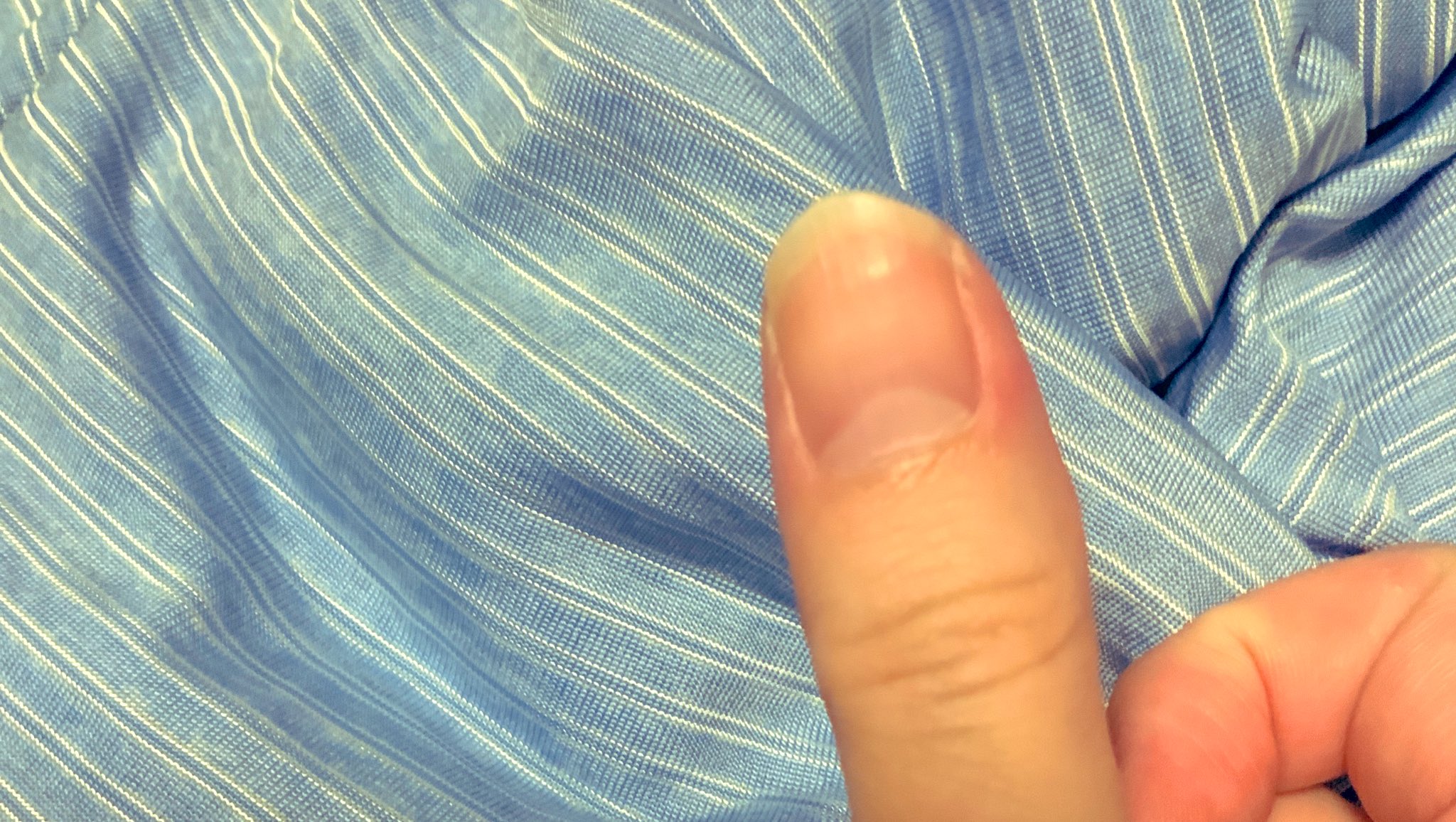 ダウンロード済み 親指 爪 横長 ネイル画像だけ ダウンロード済み 親指 爪 横長 ネイル画像だけ