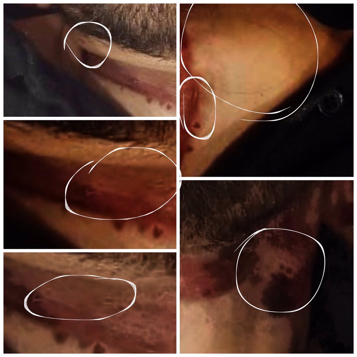 Almacreativa_1's tweet photo. As needles marks on neck,feet &amp; cellotape!Rhea drugged him took him psychiatrists!A murder via”Electronic Shock”Have strong vibe that a doctor involved too!Sushant must be not agreed defended himself badly till last!Hugh Planned Murder!#ArrestRheaChakroborty #ArrestCulpritsOfSSR https://t.co/PCNhuh3c8W