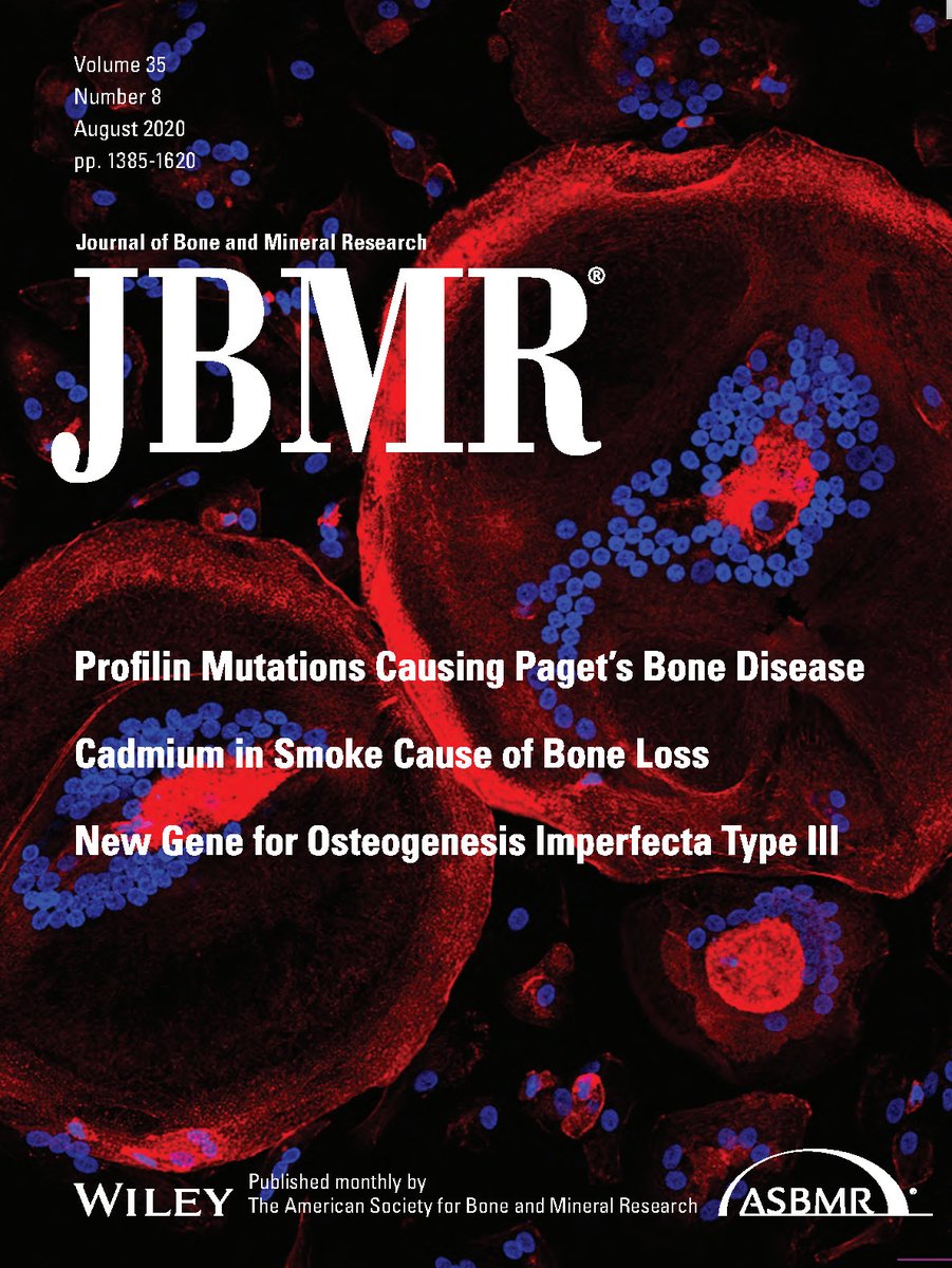 Changes in Bone Mineral Density During and After Lactation in Ugandan Women With HIV on Tenofovir‐Based Antiretroviral Therapy #JBMR ow.ly/kpXL50BbXhQ