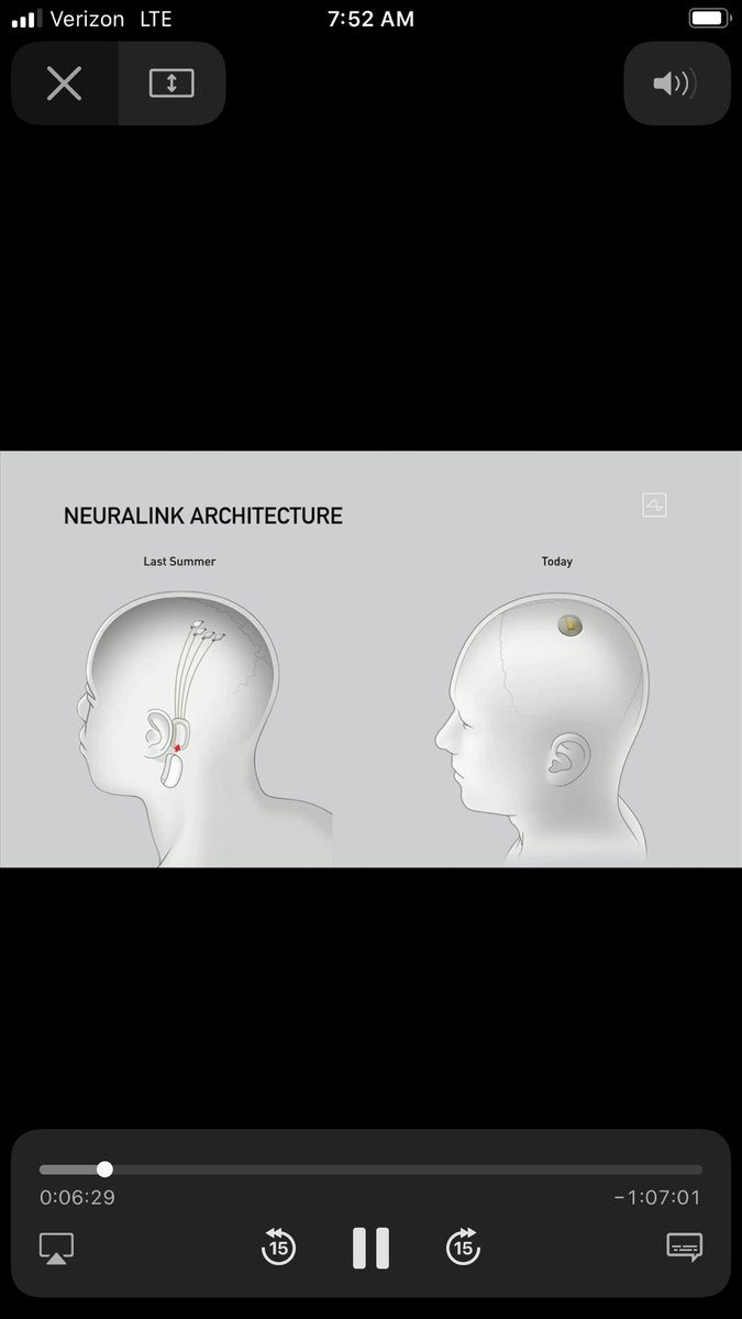 kaeyamaj's tweet image. Never again will I lose a wink of sleep over feasibility fears of my startup. Thank you @elonmusk 🙏🏽 #NeuralLink