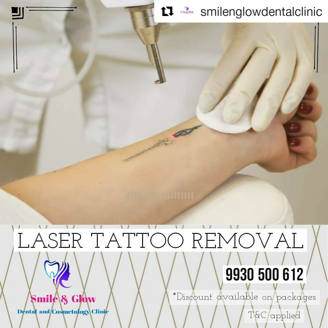 Tattoo Removal at best price in Navi Mumbai | ID: 18293940488