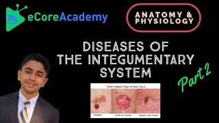 eCoreAcademy's tweet photo. Check out AJay's latest Anatomy and Physiology video called "Diseases of the Integumentary System (Part 2 of 2) | eCoreAcademy | AJay Raj"!
YouTube Link: https://t.co/1PxN9sltBd
#eCoreAcademy #elearning #STEM #enrichment #anatomyandphysiology #diseases #integumentary #system https://t.co/qGAaPAUIWV