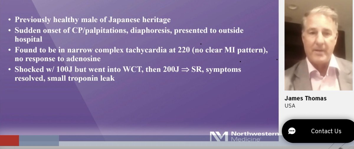 hvanspall's tweet image. #ESCCongress #MultimodalityImaging in #CardiacSarcoid presented by James Thomas @NMCardioVasc.
Case of a young man presenting with narrow complex tachycardia (ventricular origin). Had wall motion abn’s in nonvascular distribution on Echo, normal coronaries.
Teaching points👇🏼1/2