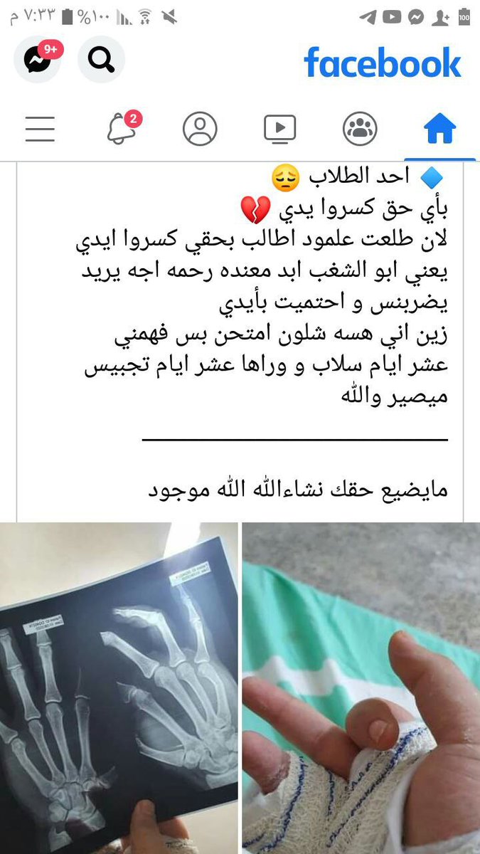 FbcKhatab's tweet photo. @IraqiPMO @MAKadhimi ربي ينتقم منكم مثل مسويتوا هيج بطلاب https://t.co/LYAo3Yr2lv