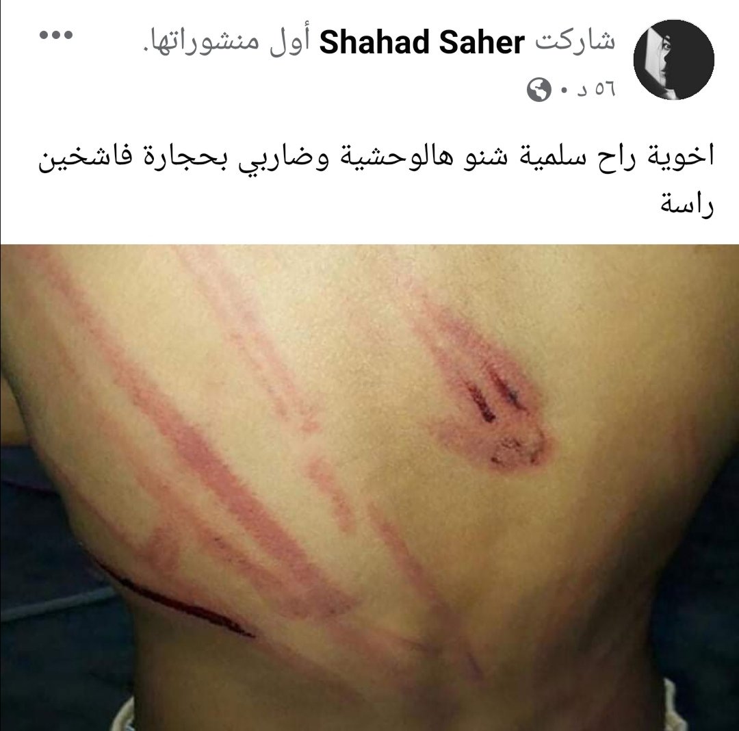 Haidog5's tweet photo. #التراكمي_الاختياري_مطلبنا
#الطلاب_تقمع
وينها حقوق الأنسان وينها الأنسانيه https://t.co/zSuApCxfs3