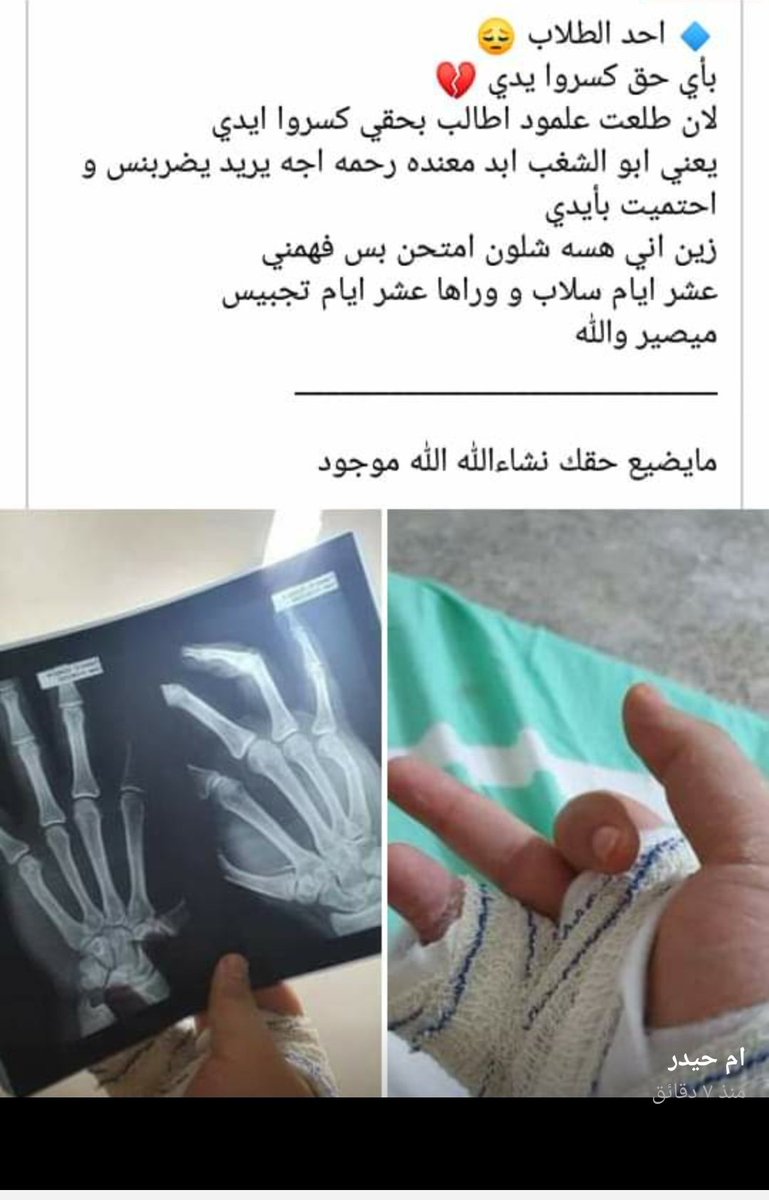Enti19dhar's tweet photo. @IraqiPresidency @BarhamSalih #طلاب_التراكمي_يقمعون #الطلاب_تقمع #التراكمي_الاختياري_مطلبنا https://t.co/sz7Iuk53DR