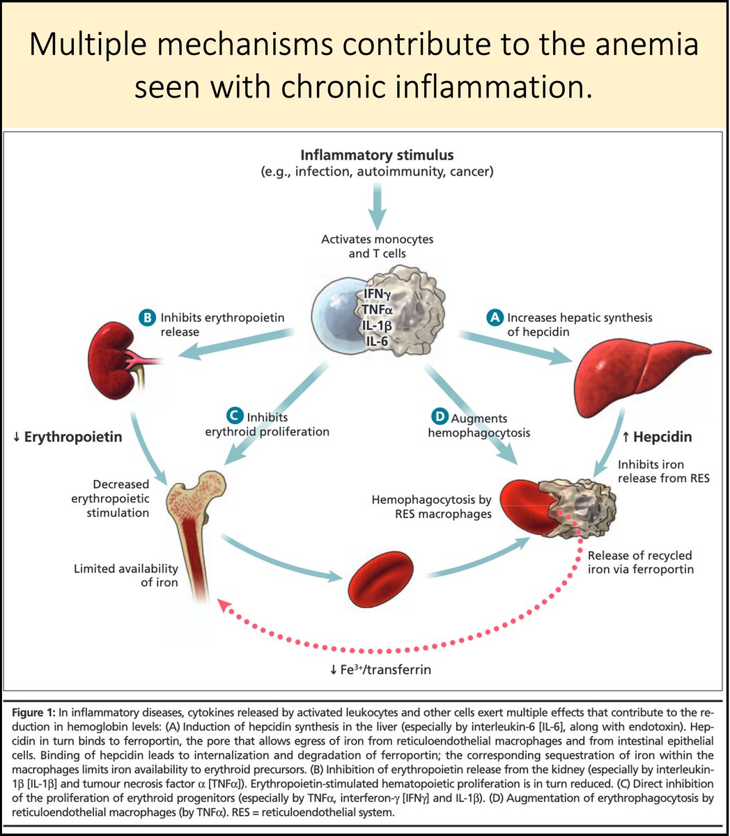 7/Because iron is sequestered inside macrophages it is not readily available for RBC production.Result: anemia of chronic inflammation (AI)[Note: there are many other mechanisms contributing to AI. See the Pic/Link.] https://pubmed.ncbi.nlm.nih.gov/18695181/ 