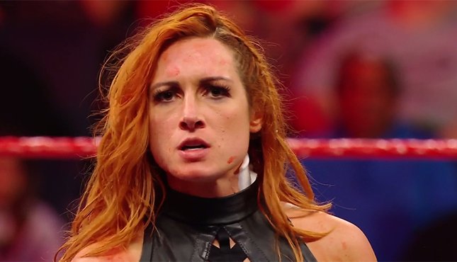 Day 110 of missing Becky Lynch from our screens!