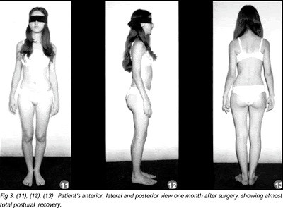 11/ If you are one of the little girls who was like me, who had to stand in your flowered underwear while they touched you over and over again - no, I will not go to an assessor. I would rather die than do that.Many of us will just disengage and die instead. Their goal I guess.