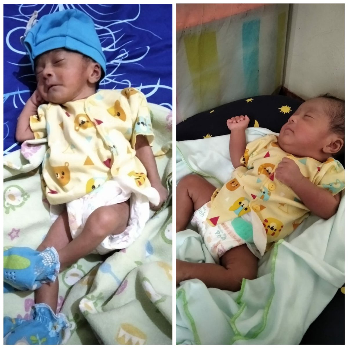 InkubatorGratis's tweet photo. Bayi Mihalka Thifal
Foto Kiri: Sebelum Peminjaman (1,47 kg)
Foto Kanan: Sesudah Peminjaman (3 kg)

#alumni #bayi #bayilucu #senyum #sehat #bahagia #keluarga #indonesiasehat
#inkubatorgratis #bayiprematur #bayikuning #agenrelawan #saveourbabies #ibu #generasi #nusantara #indonesia https://t.co/8HDJhAjxjh