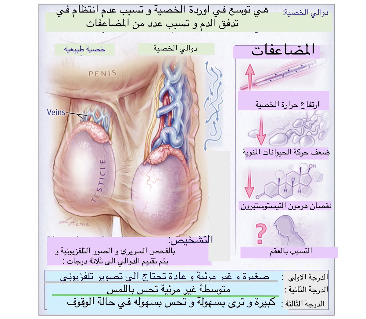 Dr Amjad Almaslamani Md Frcs On Twitter دوالي الخصية باختصار