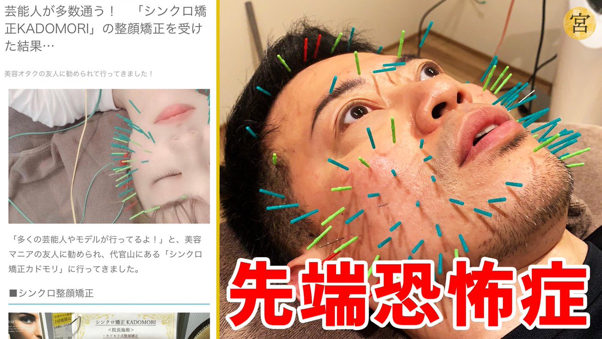 宮迫 先端恐怖症です チームにも何回も伝えてます 顔に針刺すとかめっちゃいややん これで結果出んかったら許さへんからな T Co Pbuzhk8sif 宮迫 先端恐怖症です チームにも何回も伝えてます 顔に針刺すとかめっちゃいややん これで結果出んかったら許さへんからな T Co Pbuzhk8sif