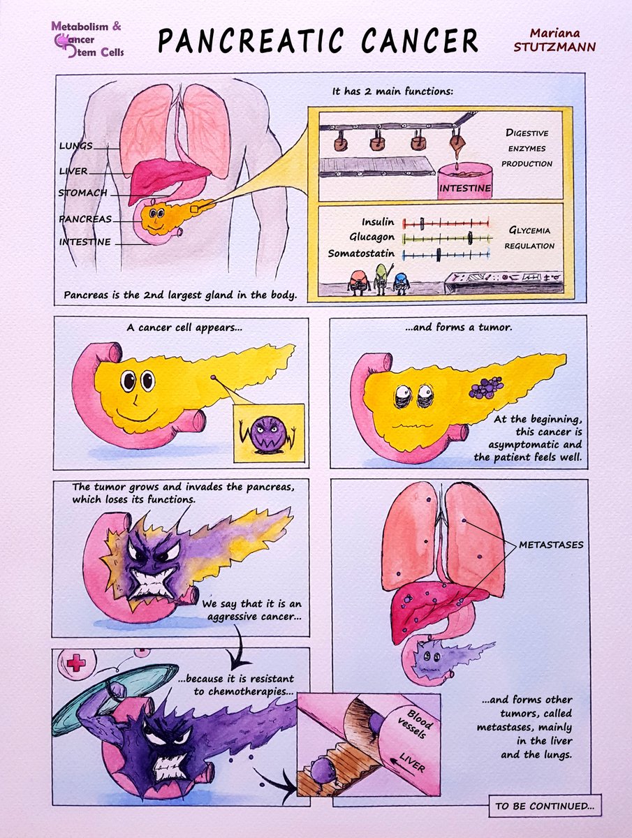 Cancer pancreatic enzymes. Pancreatic cancer prevent