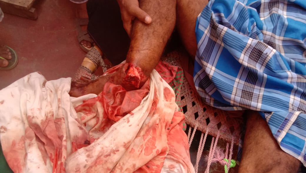 AimimGhazipur's tweet photo. ग़ाज़ीपुर UP के दिलदारनगर थाना के कुछ सिपाहियों ने रात के 2:30 बजे के करीब सलीम कुरैशी को उनके घर में पुलिस ने इतना मारा है जिससे उनका पैर व हाथ टूट गया है।आप श्रीमान महोदय फोटो में गरीब जनता का तड़पता दर्द देख सकते है।हमें आपसे न्याय की उम्मीद है@Dgpup @Spghazipur @AIMIMNational https://t.co/Dd3lUYX50S