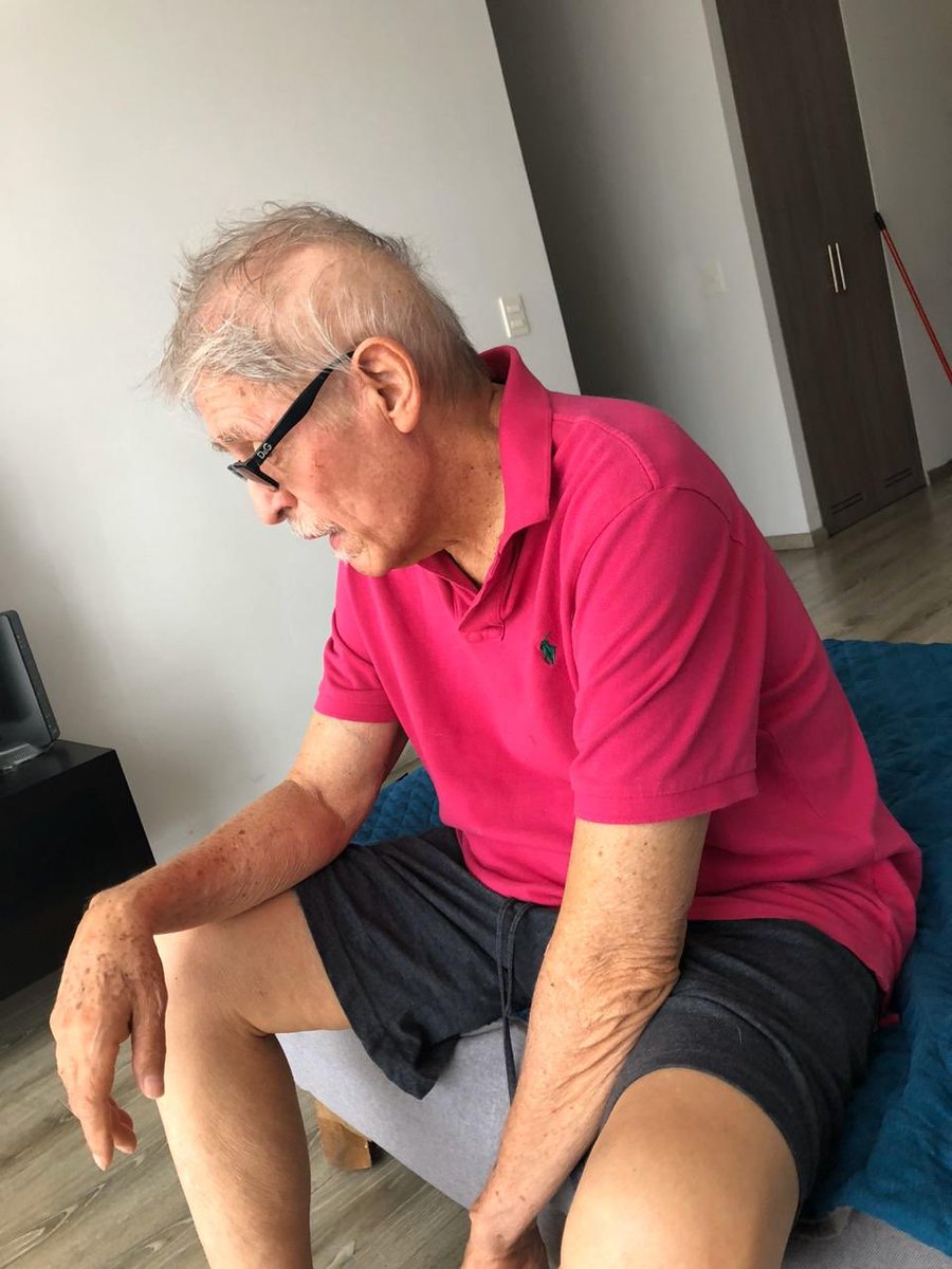 dgomezalmaguer's tweet photo. Myelofibrosis... before and after H. Stem Cell Transplant. Ruxolitinib.... just gave him hope, Nothing really solid! One year after HSCT. https://t.co/3unduxJQfJ