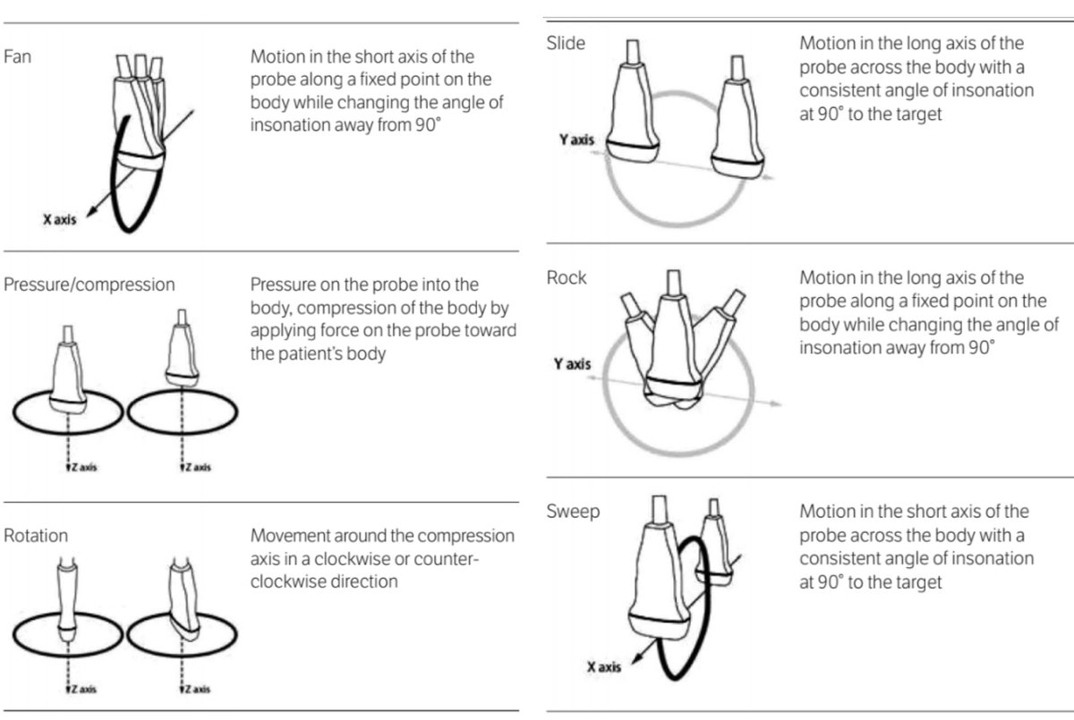 DanMirsch's tweet photo. Always good to review Cardinal Movements of #POCUS at the beginning of a new academic year.
Thanks @CreaghB #davidbahner and the @OSUultrasound team for this 2016 review on the topic.
https://t.co/XW0hVwNnVQ https://t.co/xiRiMNIgmE