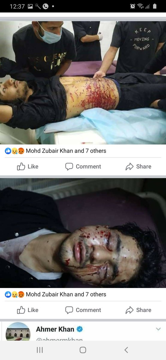 MuslimBamcef's tweet photo. Pellets victims of mouram procession  taken out in kashmir .@WamanCMeshram @IBamcef @msajjadnomani @ProfVilas @khamenei_ir @Iran @geonews_urdu @TurkeyOIC https://t.co/Qk2GzmIeXJ