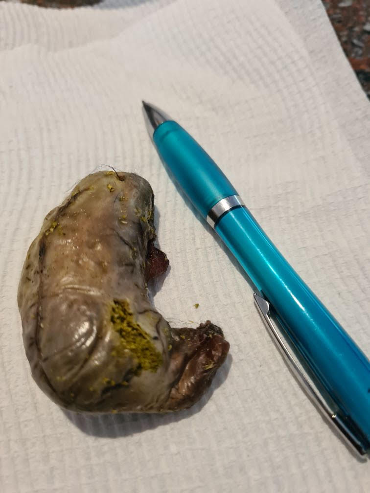 This is the latest dog bait - a kidney expertly sliced and filled with suspected rat poison - found at Dernancourt this morning adelaidenow.com.au/truecrimeaustr… <a href="/BenCameron4/">Ben Cameron</a> <a href="/theTiser/">The Advertiser</a>
