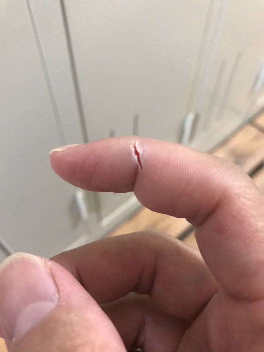 切り傷 切り傷