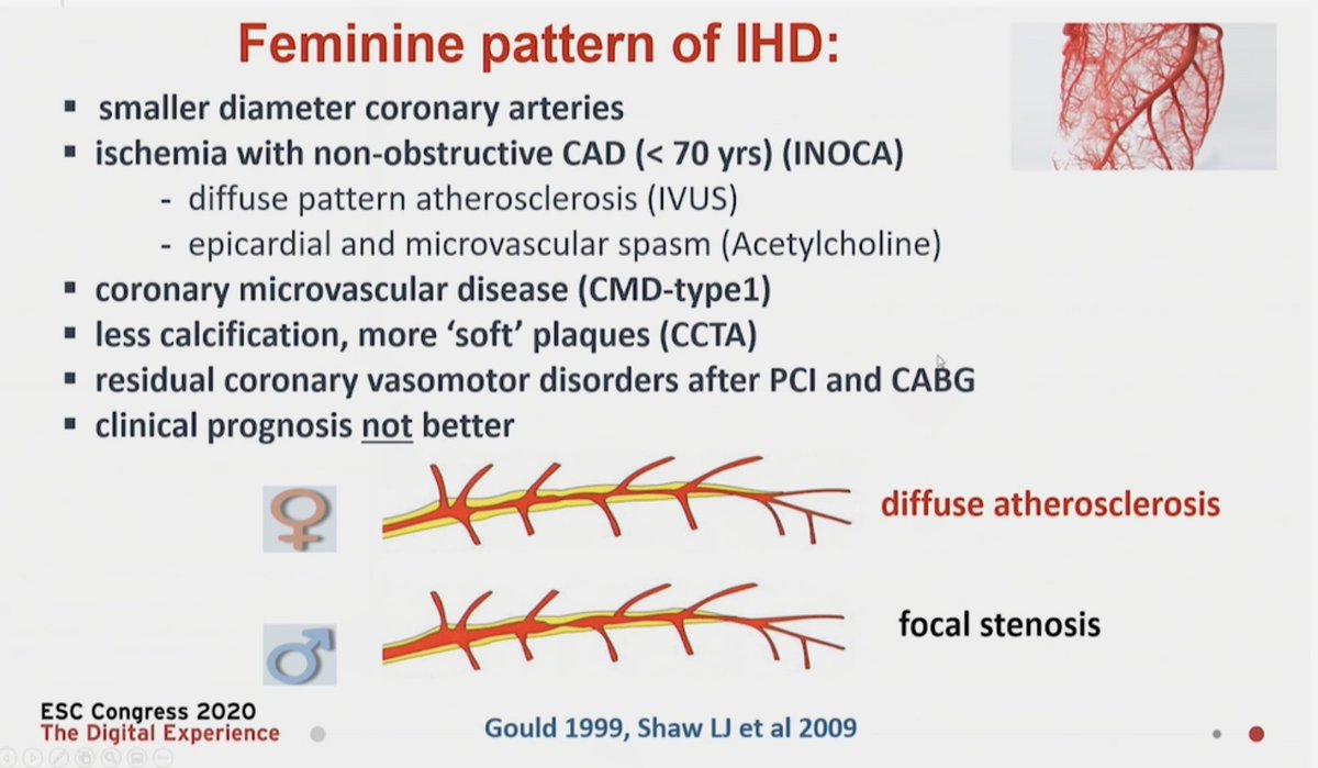  #ESCCongress  @MaasAngela shows that women have different patters of IHD Women with more diffuse diseaseMen with more focal lesionsPrognosis not better for 