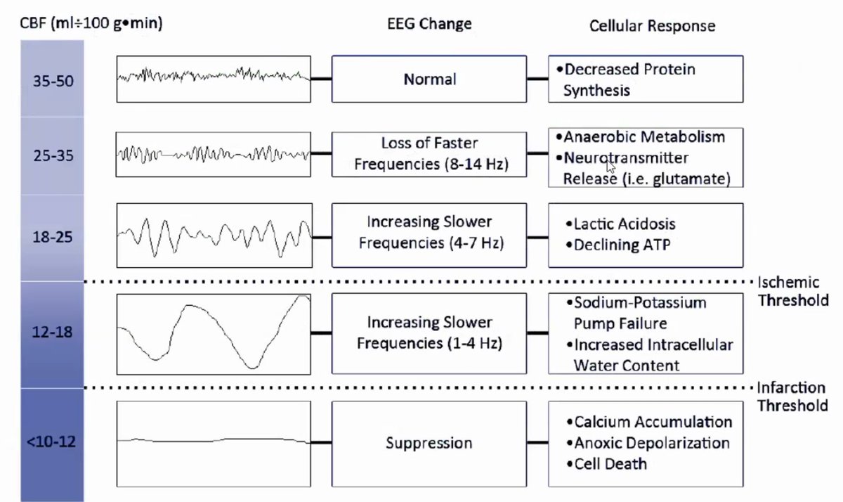 I like this table from Foreman & Claassen in Critical Care 2012 which summarizes the cellular and EEG changes that occur with progressive loss of cerebral blood flow. 9/