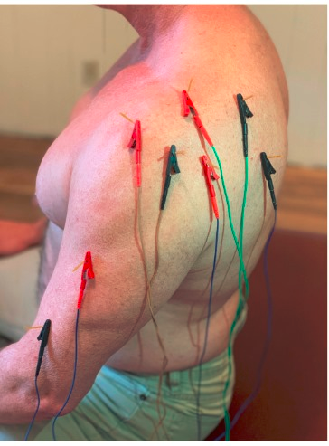 PhysioMeScience's tweet photo. Is electrical dry needling the new PT panacea or a huge theatrical placebo?

https://t.co/dUHA9DiE1e
https://t.co/zrr9POTZMN
https://t.co/vv1jbbNqZZ https://t.co/F9ZhZenkjk