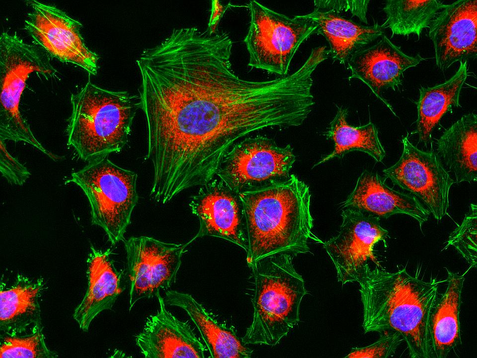 here for example is a stained slide of some epithelial tissue (or some other kind, who knows)in fact here are a bunch of kinds of tissue (a bunch of similar cells)stain and magnification aside--themselves an visual aides--this is what cells "look" likewhat have you learned?