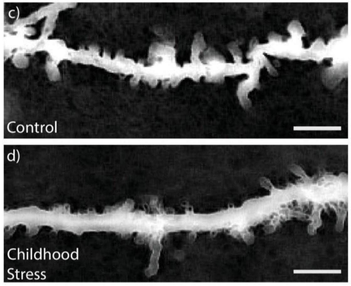 Here's a picture demonstrating the spine changes. Top, control, bottom, childhood stress. These spine changes also correlated with the levels of glucocortioid receptor mRNA and protein.