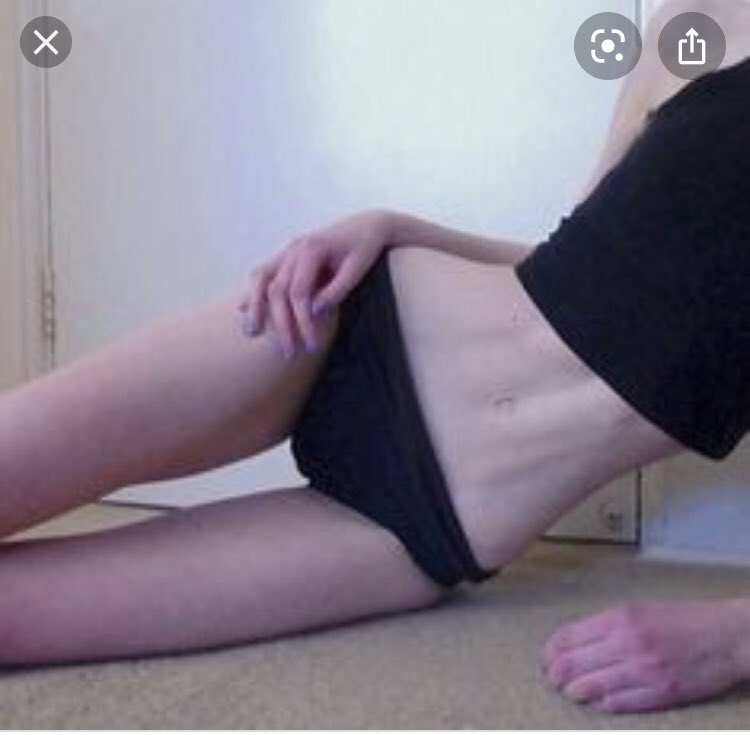 deadandskinny_'s tweet photo. Bonespo! #proana #eatingdisorder #bonespo #bones #thinspo #legspo #diet #loseweight #skinny #skinnyspo #ribspo #legspo #edtwt #loseweightfatty #fast #proed https://t.co/01bQ0N5zwN