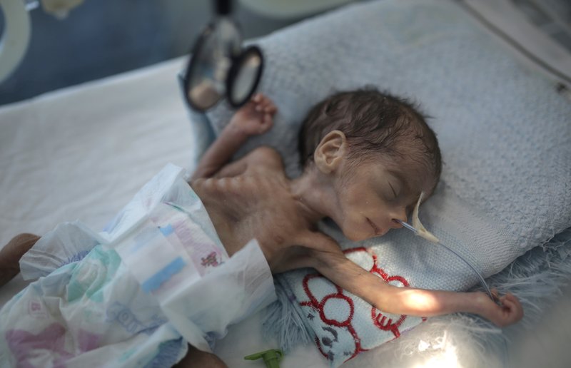 MarryAneli's tweet photo. Leader of ‌Iran:
The so-called United Nations does not fulfill its duty, and so-called human rights institutions are dead. The slogan "Defending the rights of children and women" does not apply to the oppressed children and women of Yemen and Palestine.

#2000DaysOfWarOnYemen https://t.co/AOm2i8EvBS