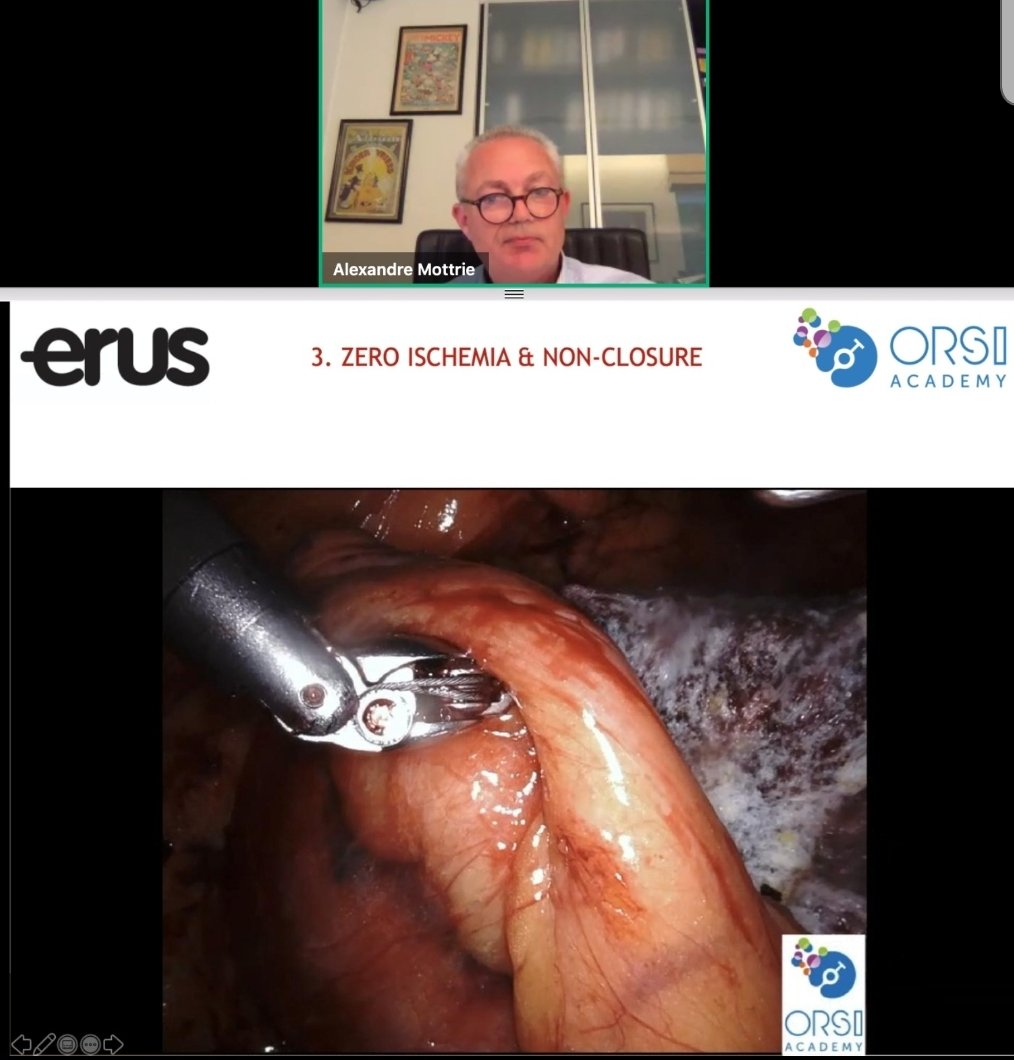 marciomoschovas's tweet photo. Great lecture today given by @alexmottrie at @Uroweb . Different techniques for robotic partial nephrectomy. @ERUSrobotics @orsiacademy @EUplatinum @EAU_YAUroTech #roboticsurgery @AalstOlv @OLVZaalst https://t.co/OLEBElHYfm